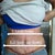 PO Day 9: swollen but shrunken from pre op measurements