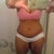3 weeks post- op
yea!!! no more tape