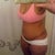 3 weeks post- op
