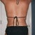 30 days PO:  Back view...no more back rolls...yeah!