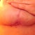 right breast is finally healing 7wks
