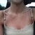 Photo #1: (Day 1) On my way to surgery