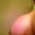 8 weeks. Right breast. Looks like a snoopy deformity to me.