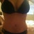 3 weeks post op - belly is bruised still :(