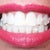 The 9th tray is approx 3 1/2 months time period.  You can see my teeth are already straighter.  I have to clean them again because the teeth that shifted show hidden tarter areas.