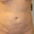 6 wks front view.
