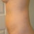 6 wks side view.