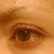 Left eye before