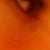 Right eye after