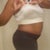 Pre-Op:  Side View 6/25/12 (7 days before op)