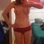 2 months post-op