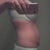 From the side tummy tuck pre-surgery