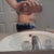 post op 3days