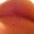 Underneath my left breast which had a tiny hole pop and caused scar to pull breast upwards and inwards slightly.