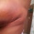 wanted to get a close up of the bruising and rashes around the bruises. So weird