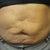 Picture months before surgery