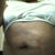 Picture months before surgery