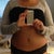 4 months post op