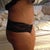 4 months post op