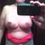 13 days post-op