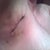 Right under arm incision.