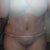 3 days post op