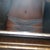 12 days post p
