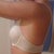 4 weeks post op