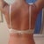 4 weeks post op