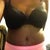 Another pic of flat side still swelling but minimal post op 21 days