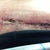 open incision