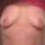 Day after explant