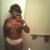 FRONT VIEW 3 MONTHS POST OP