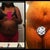 Before pic was taken in November and the after pic was taken 2 weeks PO