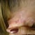 scars/bumps/stitches protruding ,left ear back