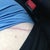 My bright red TT scar....