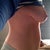 Breast side