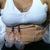 day 1 post op 3/23/11