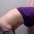 side view pre-op. See my 6 pack hanging? lol