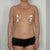 7 days post operation.