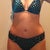 Notice how the swelling over the hips has gone down/away.  You can see the scar poking out on the left of the picture.