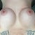 4 weeks post op