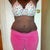10 week p.o. front view swelling above incision & right side.