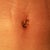 3wks 1 day po...before getting bb stitches out