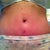 4 week PO