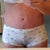 Panties hide the scar.  Still working on getting that spot below the bb healed