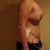 one week post opt 10-19-2010