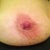 Right nip not as sensitive 