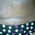 Old C-scar - pre op.  Almost invisible, my PS said he would use this line for my new scar.  Can't wait to see under the dressings.
