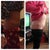 19 days post op alongside 6 weeks 6 days post op xx